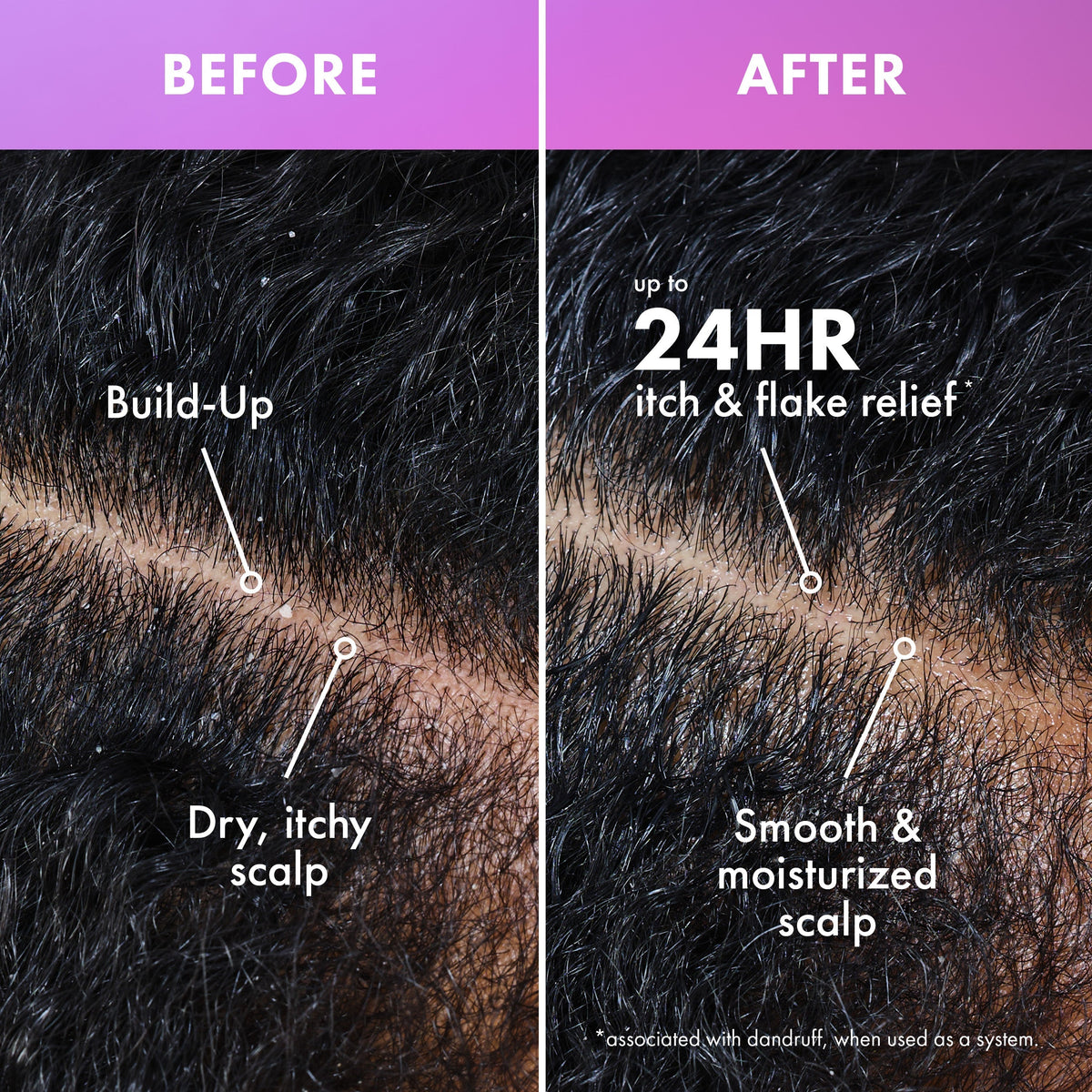 Lavender & Lychee Daily Scalp Moisturizing Lotion